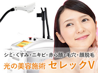 セレックV