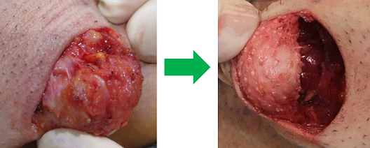 20230305診療ブログ2
