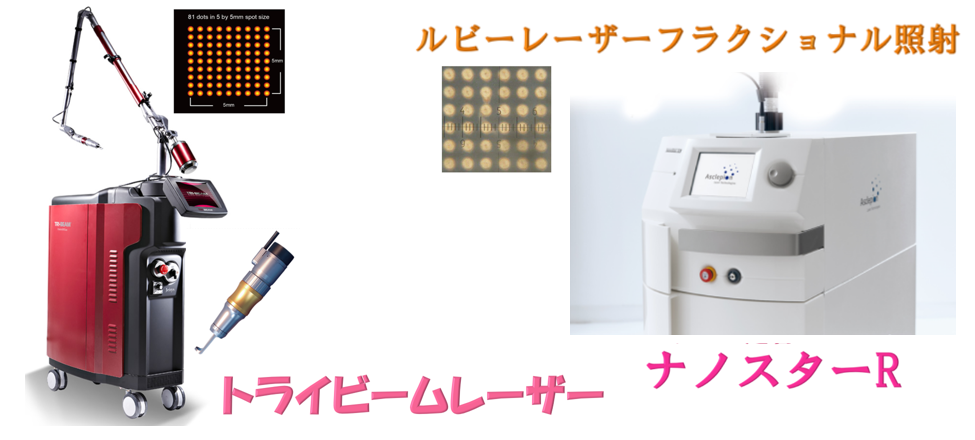 20250531Wフラクショナル